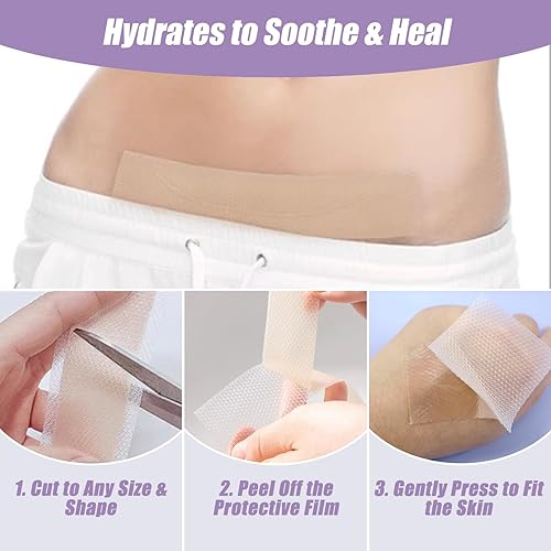Miniatura 4 de Hojas de silicona para cicatrices de 1.6 x 120 pulgadas, rollo de cinta de silicona de grado médico para cicatrices quirúrgicas, eliminación de acné
