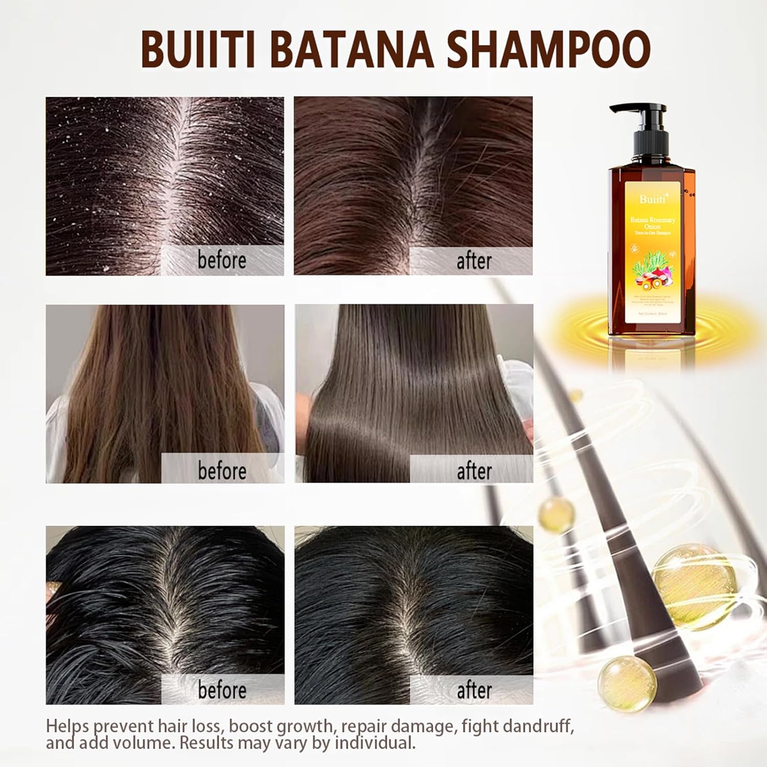 Batana Oil Shampoo for Hair Growth – Infused with Rosemary & Onion, Anti Hair Loss & Thickening Treatment for Women & Men, Promotes Regrowth, Sulfate Free Natural Formula, 10.14 fl oz (2PCS)