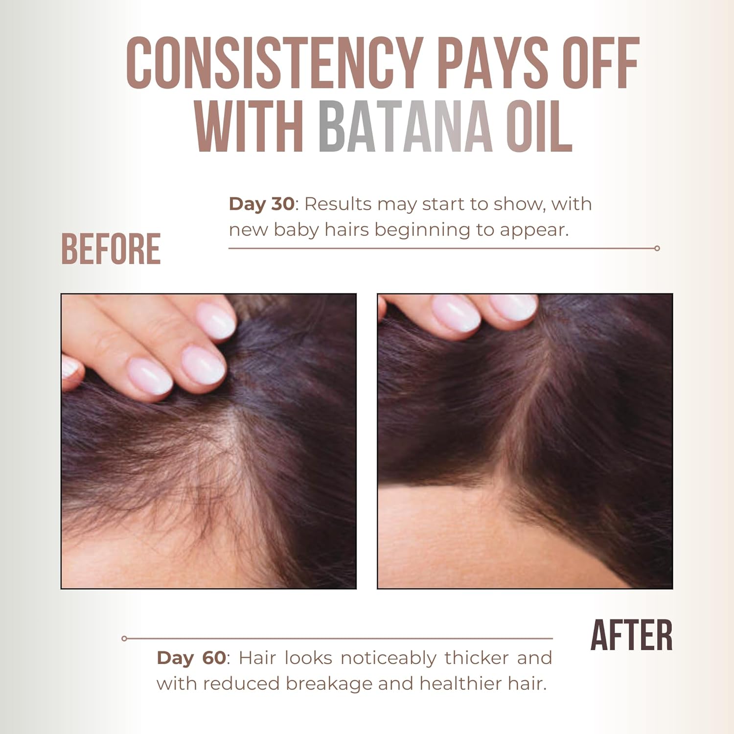 Premium Batana oil for Hair Growth |100% Raw Elaeis Oleifera for Natural Scalp Care | Dr Sebi Hair Shine treatment for Men & Women | Natural Cold Pressed Extraction Method | Liquid Formula