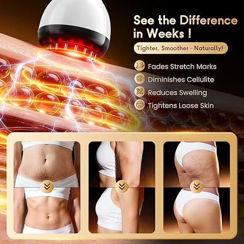 Miniatura 6 de Masajeador de drenaje linfático y herramienta de masaje anticelulitis, ayuda a reducir las estrías y la celulitis, para piernas, brazos y vientre,