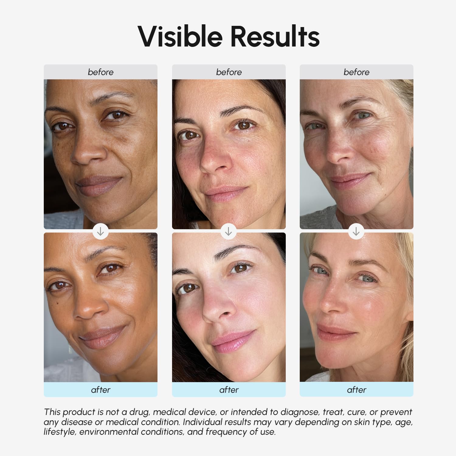 MAREE Retinol-Feuchtigkeitscreme für das Gesicht, Anti-Aging-Gesichtscreme, feuchtigkeitsspendende Gesichtscreme mit Kollagen