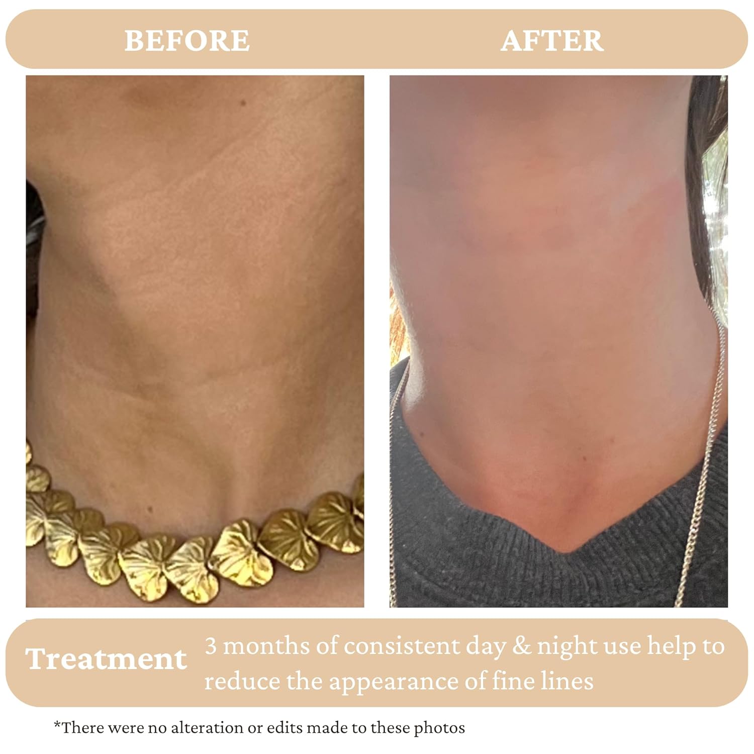 Retinol Alternative Serum