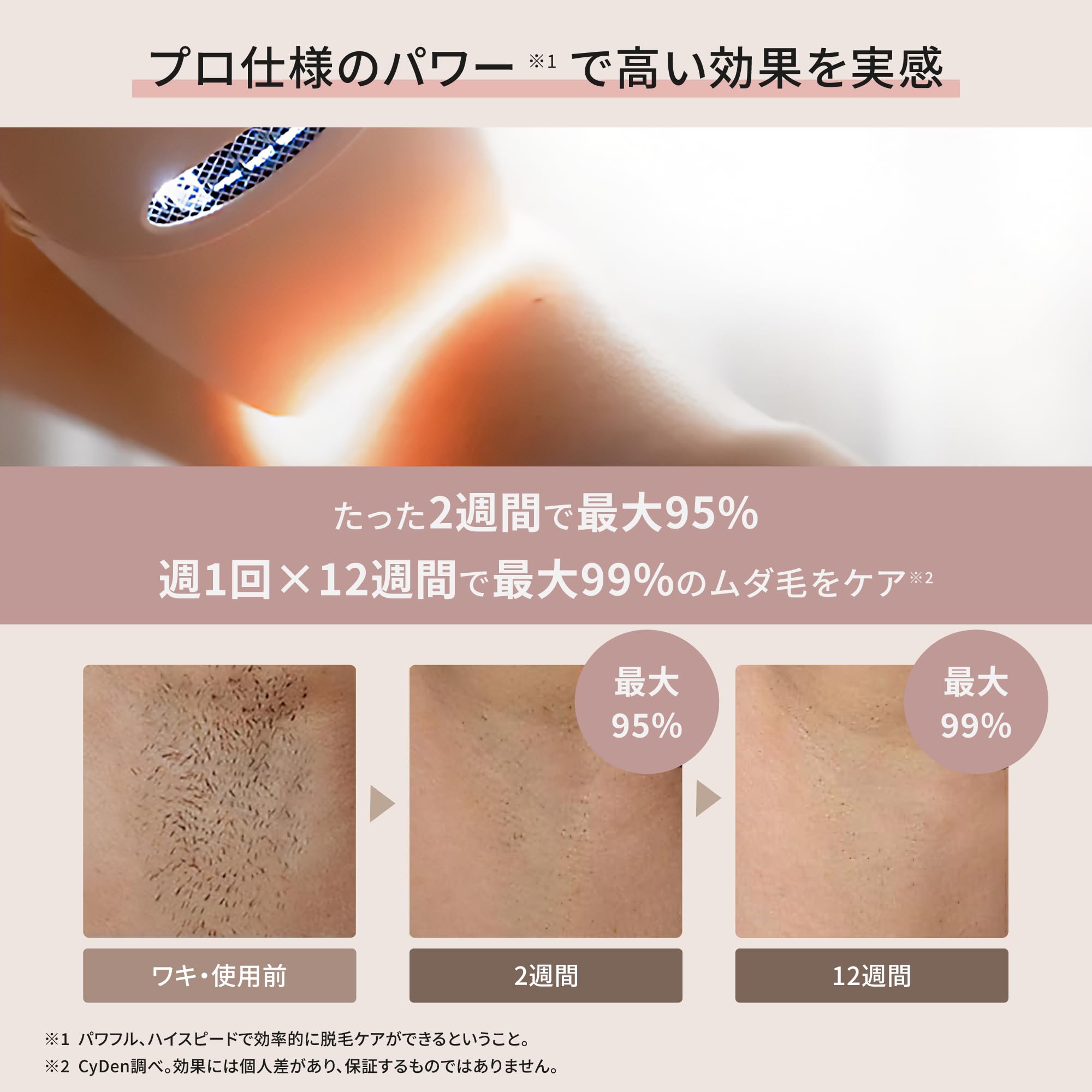 Amazon | 脱毛器 光美容器 IPL光脱毛器 家庭用 全身脱毛 VIO対応 VIO