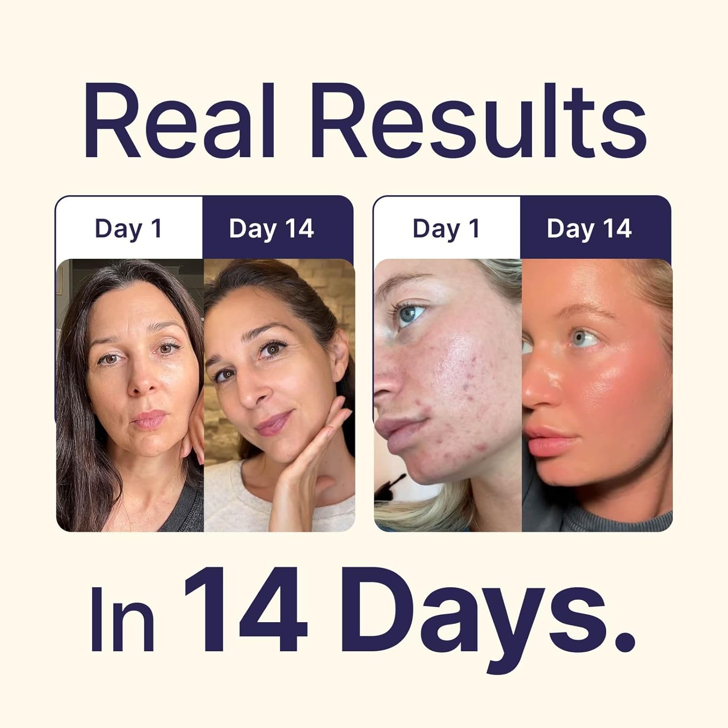 Tallow and Manuka Honey Balm, 2 oz, Unscented, Grass Fed Grass Finished, Face Cream, Body, Lotion, and Lip Balm - Image 3