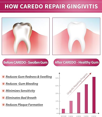 Miniatura 2 de Pasta de dientes para gingivitis, reparación de encías sangrantes, tratamiento de encías inflamadas para sensibilidad de las encías, tratamiento de