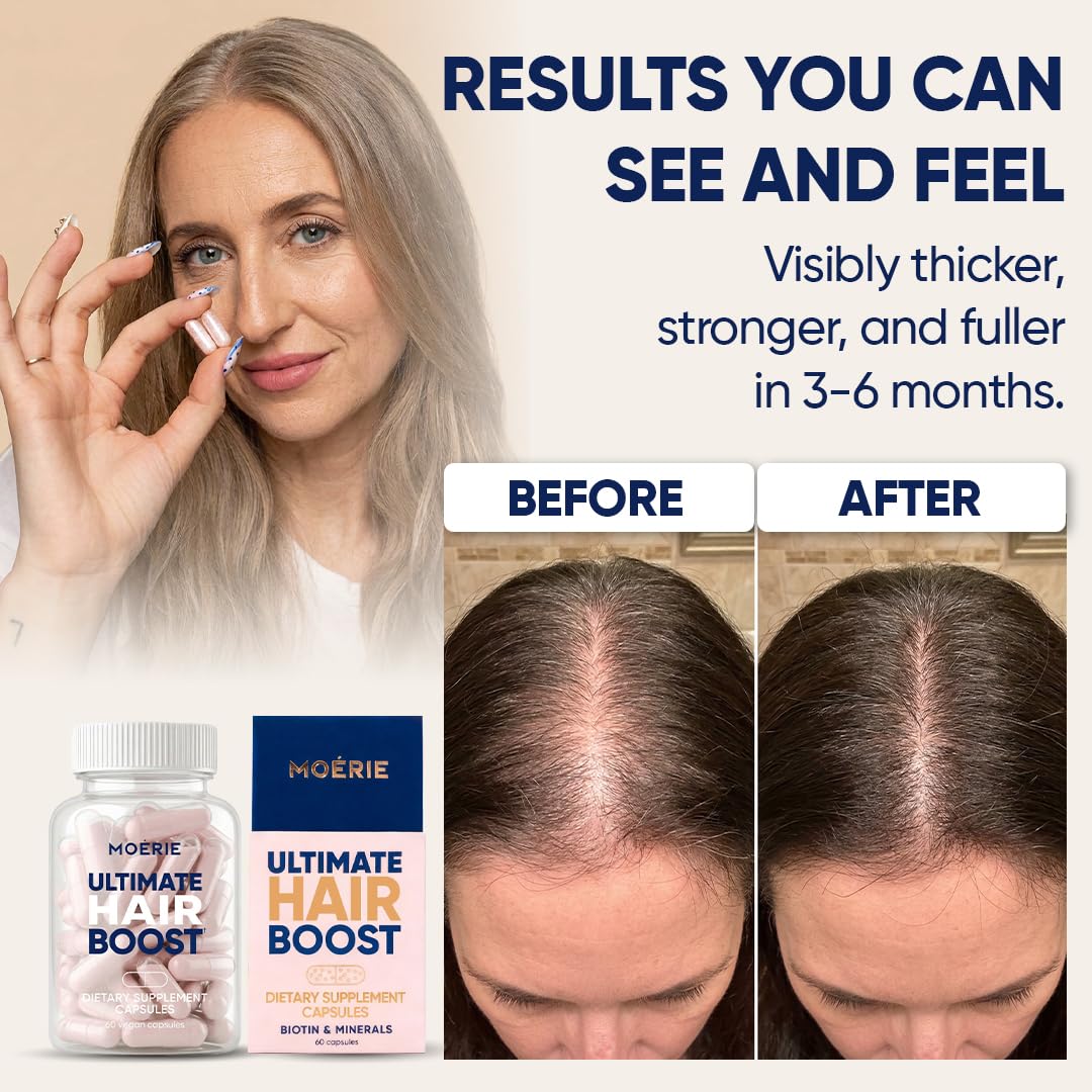 Moerie Ultimate Hair, Skin & Nail Supplements with Biotin, 60 Capsules
