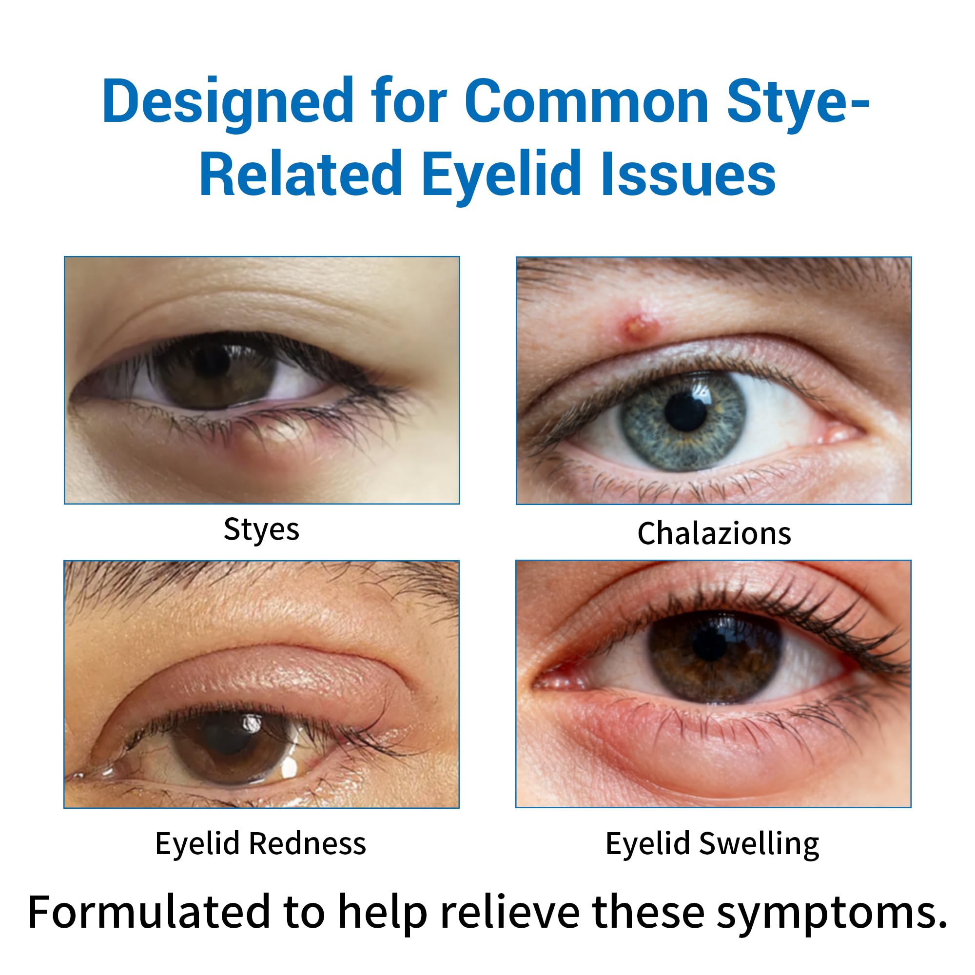 Stye Eye Relief Serum and Steam Eye Mask Kit