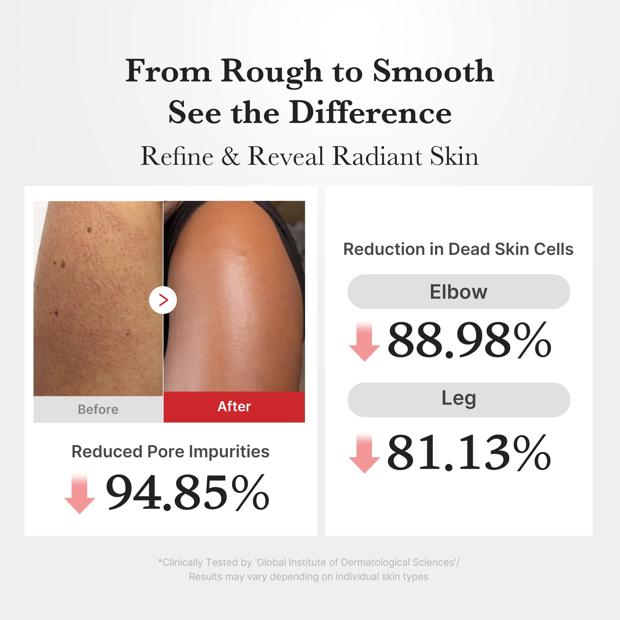 medicube Body Peel Shot with Hypochlorous Acid | Gentle Body Exfoliating Serum for Dead Skin Cells, Rough Patches & Uneven Texture | Rice Extract, Panthenol for Hydrating & Smoothing Care | 9.46 fl.oz