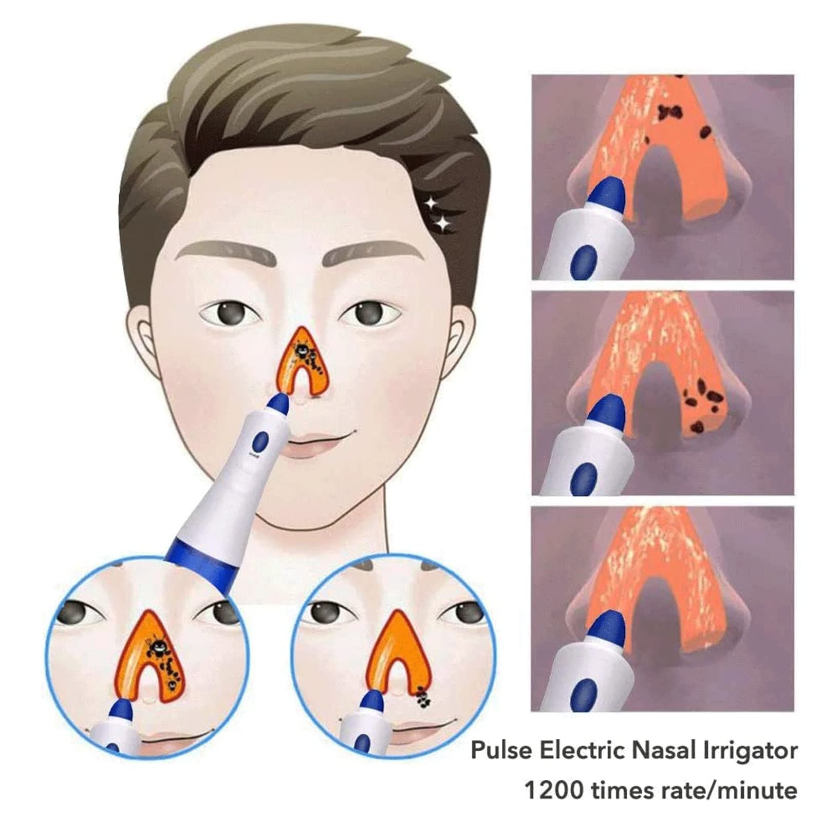 Botella De Lavado Nasal Nasal, Lavado Nasal Botella De Ducha Nasal Sistema De Irrigación De Senos Nasales Limpiador Nasal De 300 Ml para Adultos Y Niños