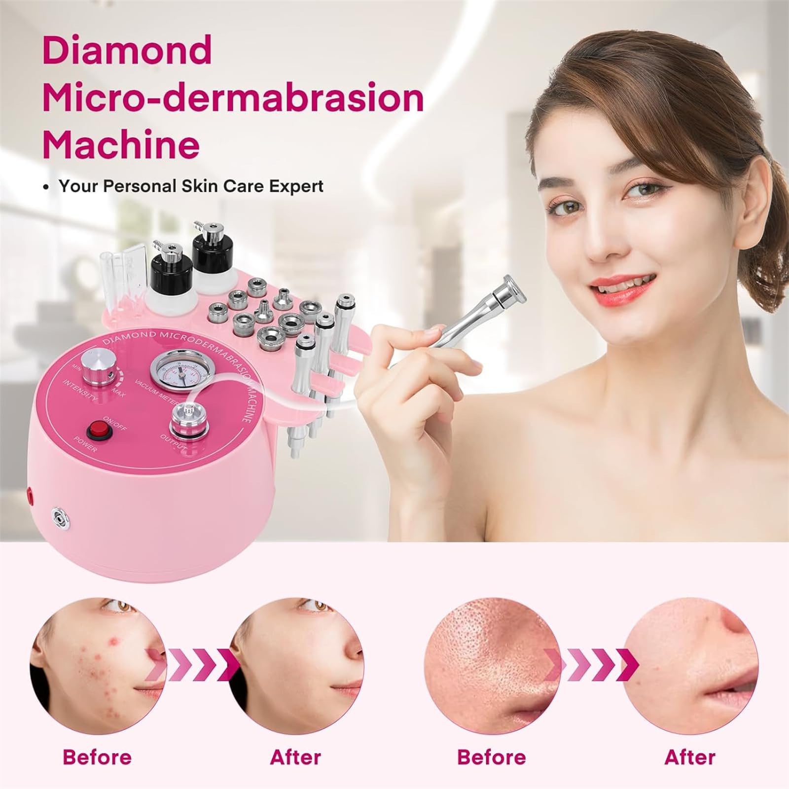 3 in 1 Diamant Mikrodermabrasion Vakuum Peeling Hautpflege Dermabrasionsmaschine Porensauger mit Zauberstab, Sprühflasche und Vakuumglasrohr für Heimschönheitssalon