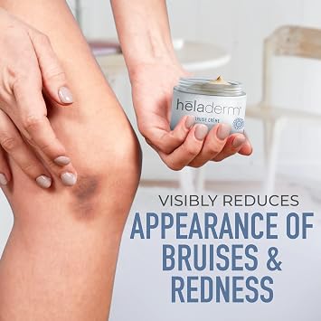 Arnica Oil Bruise Cream Extra Strength (Fast Healing) - Targeted Care to Help Restore Skins Vitality, Arnica Cream for Bruising and Swelling - More Nourishing Formula, 50mL