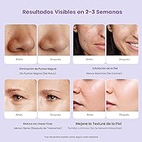 Vista 7 de UNOISETION Máquina de microdermoabrasión con diamante profesional, dispositivo de peeling facial de dermoabrasión 3 en 1 para uso personal en casa