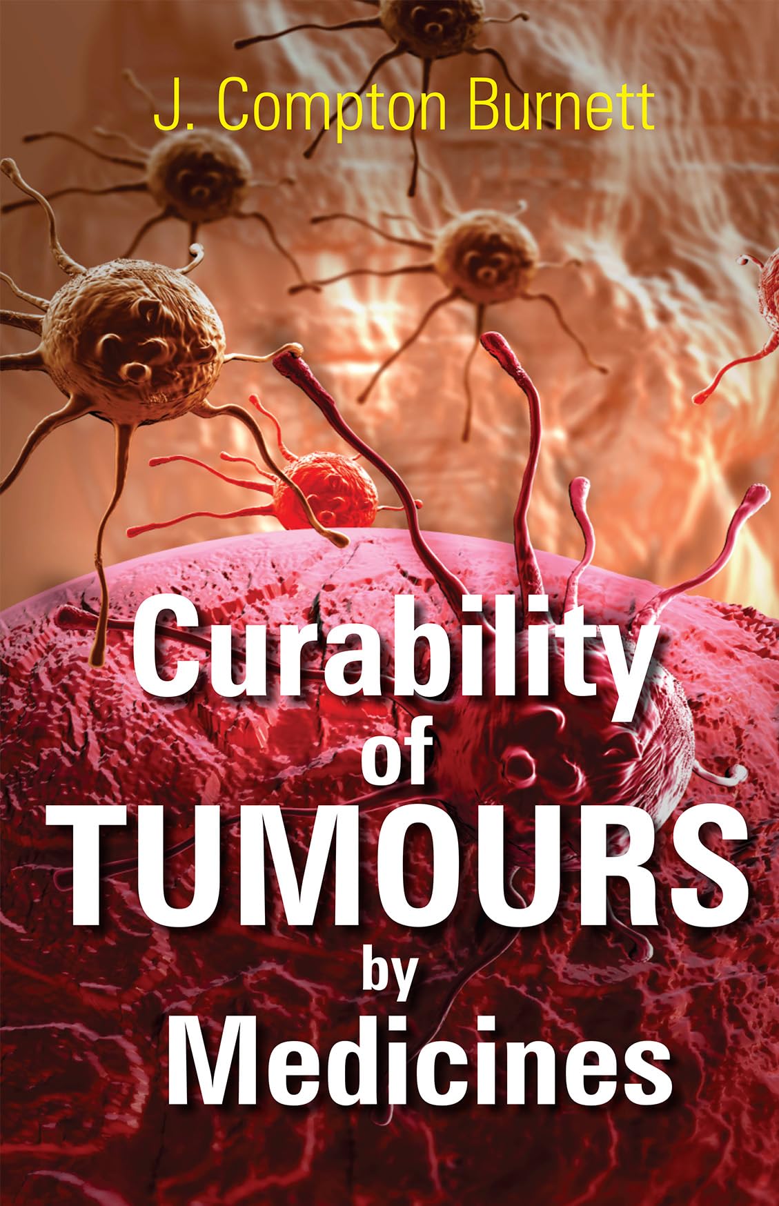 Curability of Tumours by Medicines Paperback – 1 April 2007
