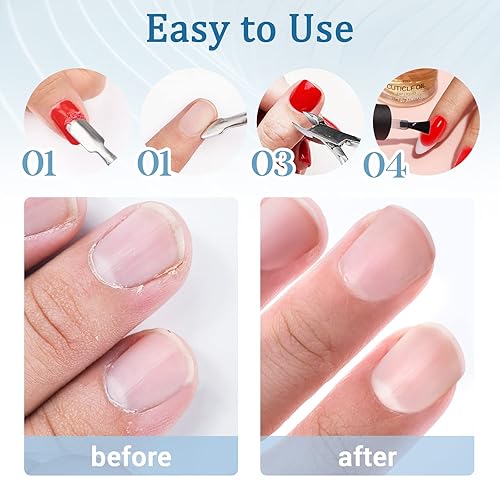 Miniatura 7 de Recortador de cutículas, removedor de cutículas, pinzas profesionales de acero inoxidable y cortador de cutículas, herramientas de manicura de