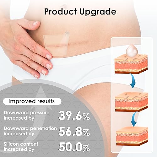 Miniatura 5 de Hojas de silicona para cicatrices, cinta de silicona para tratamiento de eliminación, cinta de cicatriz de grado médico para cicatrices quirúrgicas,