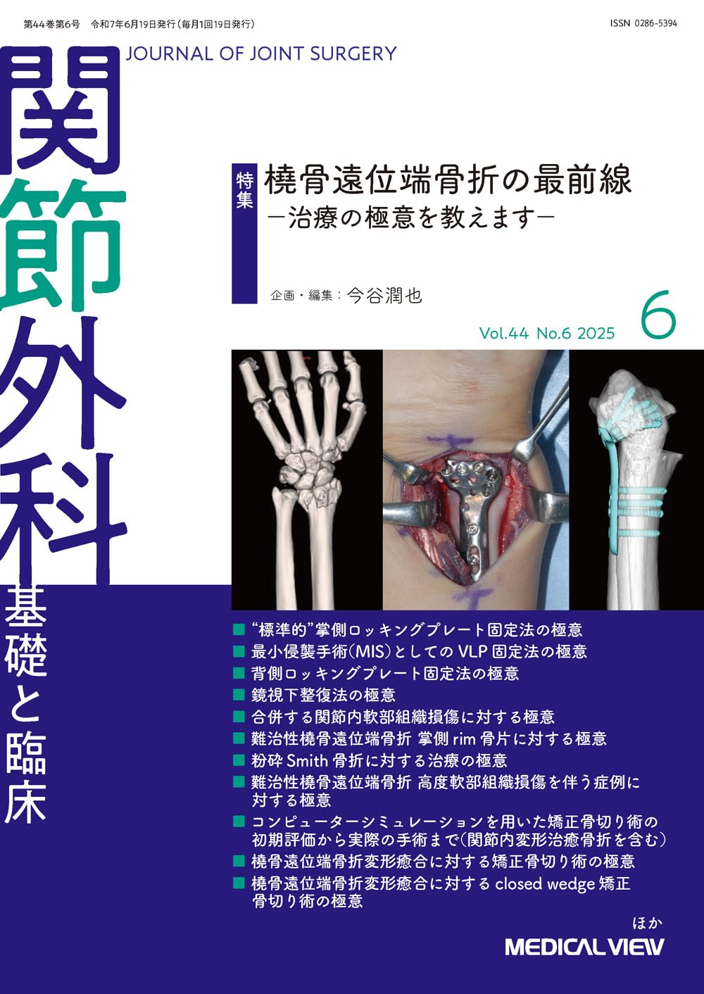 高齢者橈骨遠位端骨折の治療 早期ＡＤＬ回復をめざして  /メジカルビュ-社/金谷文則（単行本） 高齢者橈骨遠位端骨折の治療−早期ADL回復をめざして [DVD付