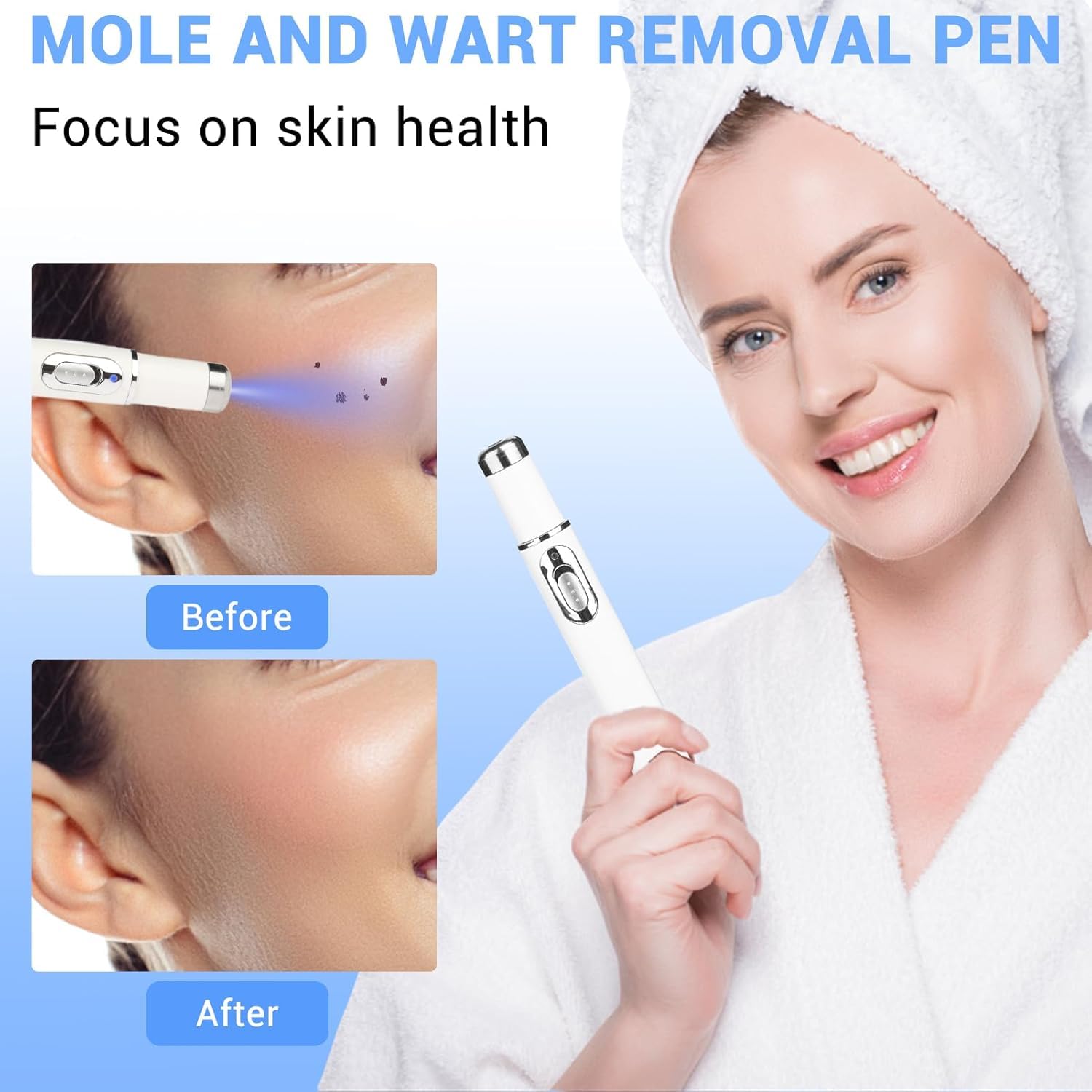 Penna laser non invasiva per la rimozione di lentiggini e verruche, penna laser per la crescita della pelle di viso e corpo, adatta per la rimozione di verruche, acne e nei