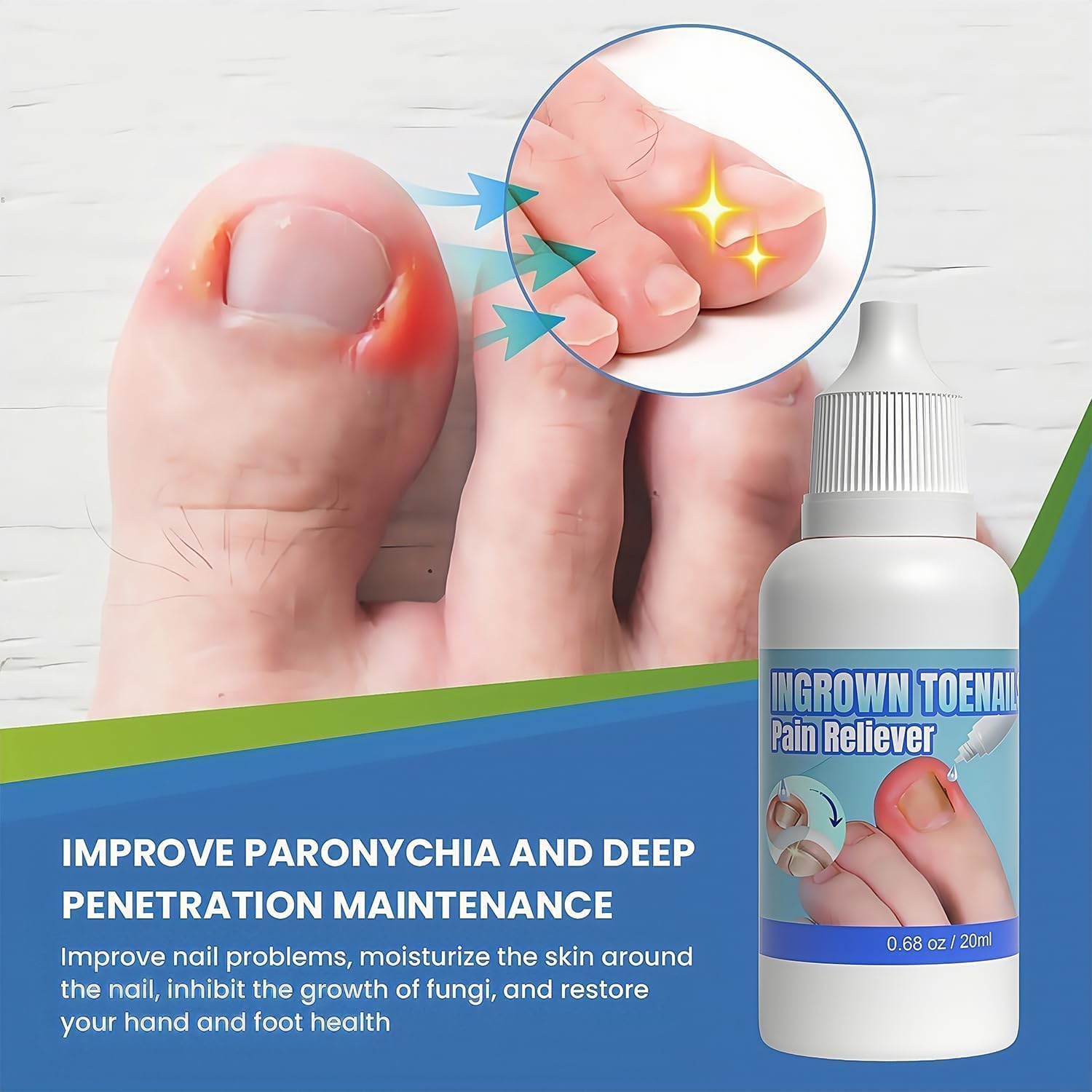 Ingrown Toenail Treatments, Ingrown Nail Treatment for Toenails Extra-Strong, Ingrowning Toenail Treatment, 20ml - Image 4