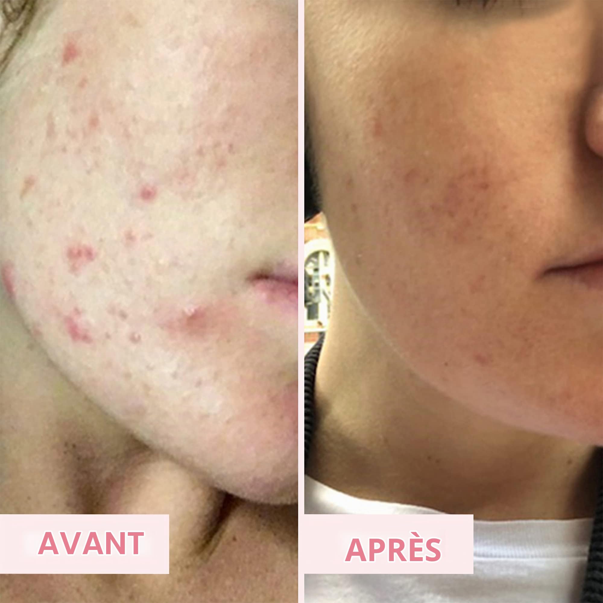 Sand & Sky Masque Visage Porefining à l'argile rose australienne Soin de la peau| Minimiseur de pores et nettoyant pour pores avec applicateur de brosse pour masque facial