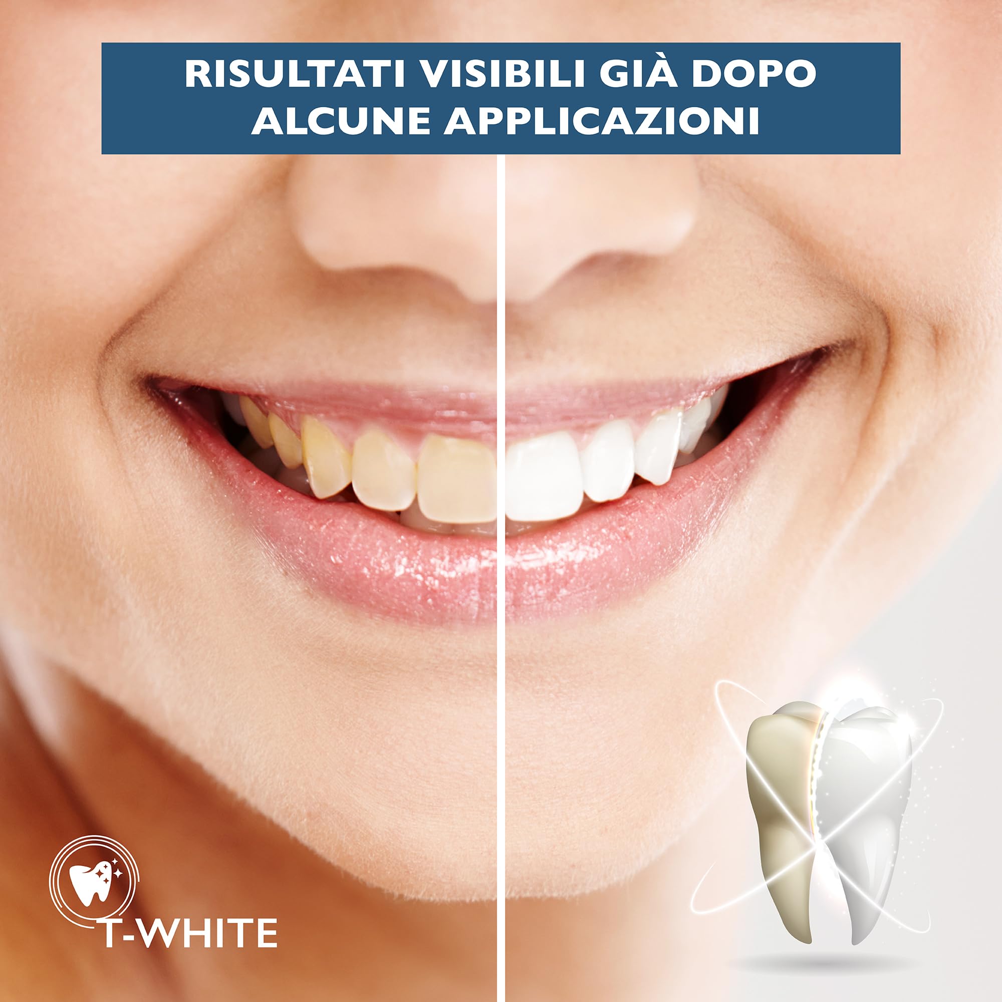 T-White - Ricarica Sbiancante Denti Professionale - 3 Gel Sbiancanti con Pennello Applicatore - Denti Bianchi in 16 Minuti - Sicuro per lo Smalto