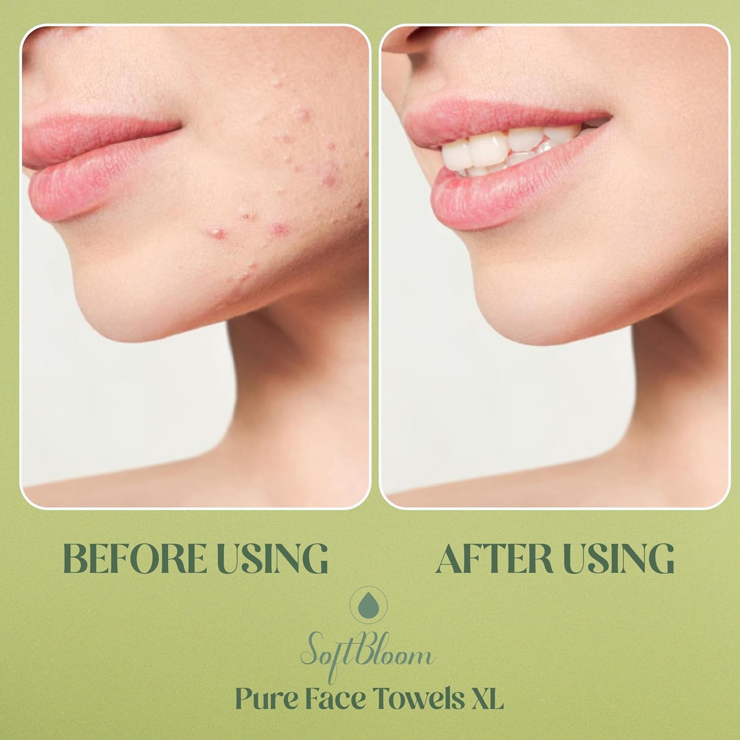 Disposable Face Towels XL for Acne-Prone & Sensitive Skin – Ultra Soft Biodegradable Viscose Single-Use Facial Towels for Daily Skincare Hygiene & Makeup Removal – SoftBloom (50 Count) - Image 4