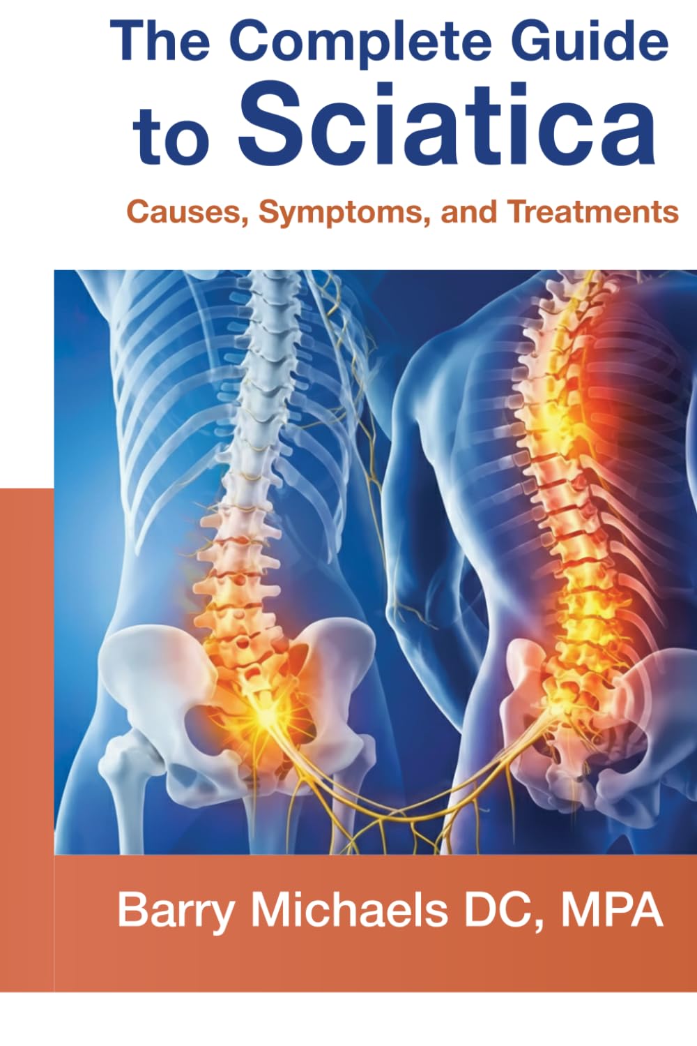 The Complete Guide to Sciatica: Causes, Symptoms, and Treatments (SERIES 2 — The Pain & Relief Essentials Understanding common sources of pain and practical ways to manage them.)