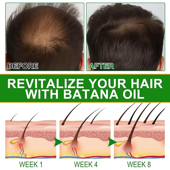 Batana Oil for Hair Growth and Nourishment - Scalp Massager Included, Honduras Pure & Natural Oil for Split Ends Elimination, Enhanced Hair and Skin Radiance, All Hair Types, 2.02 fl oz