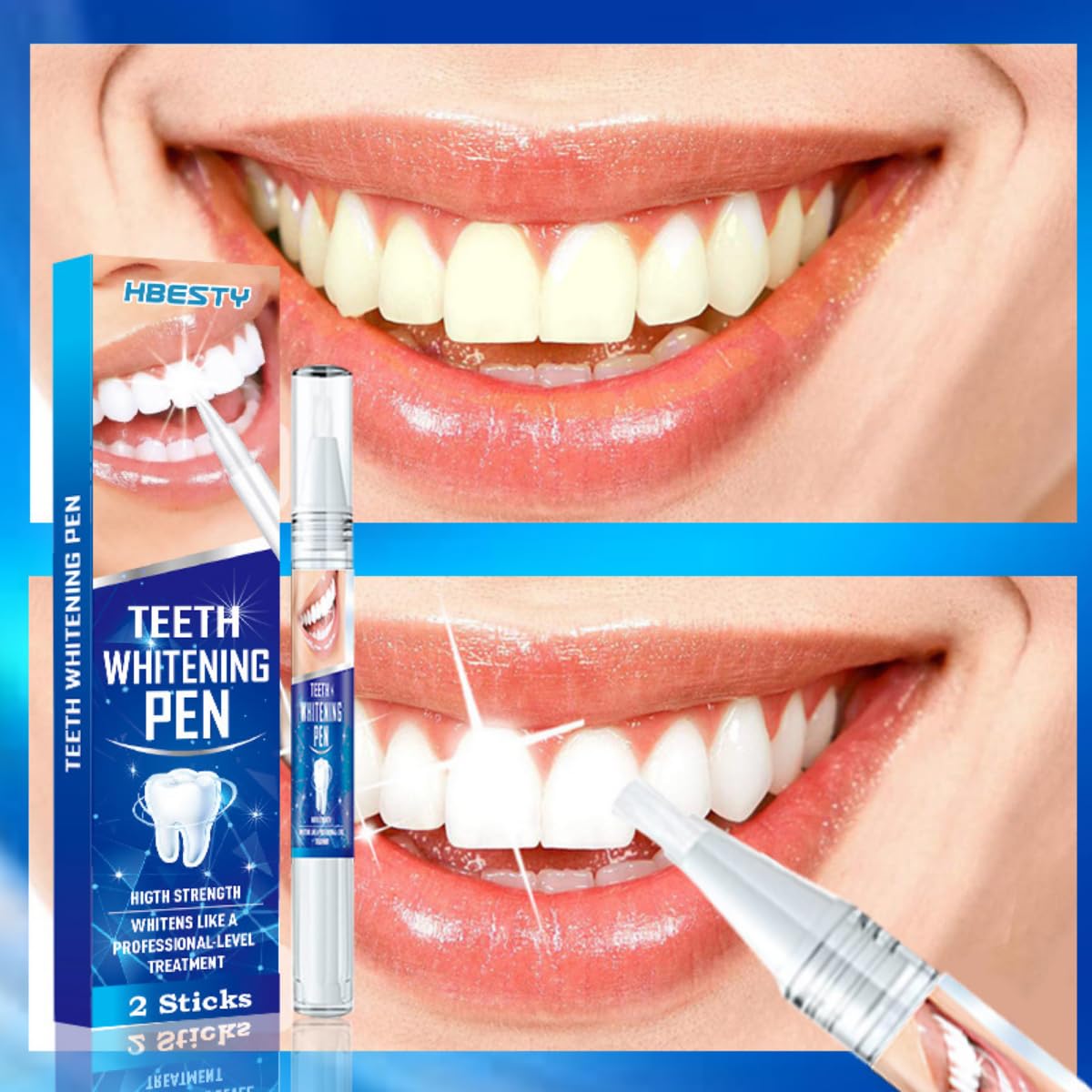 Amazon | 【tr nd】HBESTY ホワイトニングペン、TOOTH WHITENING PEN