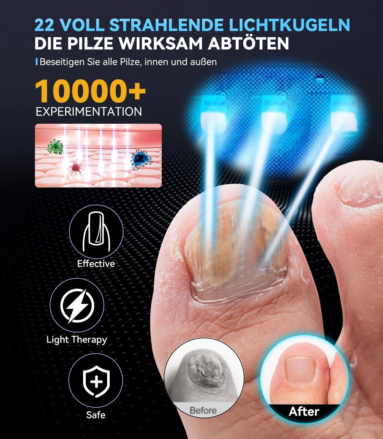 Nagelpilz Lasergerät 【21-Tage schnell】【905nm Rottlicht-Technologie】Nagelpilz Testsieger mit Timer (30s/60s/99s) Für Finger & Zehen Blau