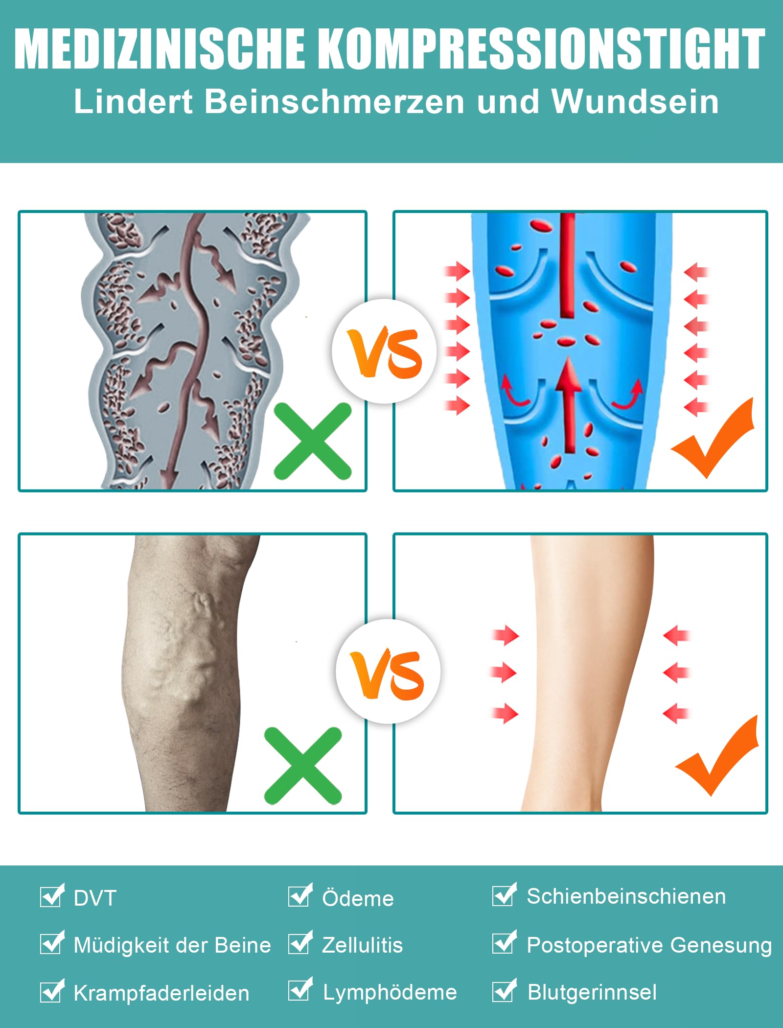 Collants de compression médicaux pour homme et femme - Longueur : 15-20 mmHg - Classe I - Bas de compression gradués - Bout ouvert - Pour la grossesse, les varices, l'œdème, le lipœdème