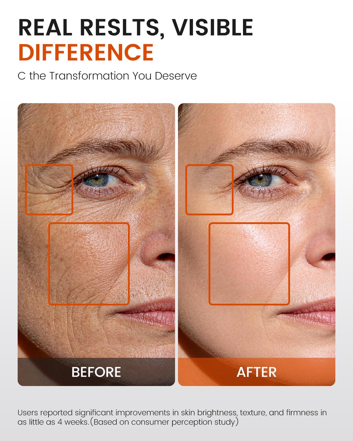 Super C Serum for Mature Skin – All-in-One Vitamin C Serum for Face with Retinol & Hyaluronic Acid for Women Over 60 & 70 – Anti-Aging Hydrating Serum for Dark Spots, Wrinkles & Fine Lines 1.0 fl.oz.
