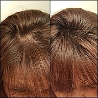 Vista 4 de Caboki Fibra de construcción del cabello + aplicador en aerosol integrado (suministro de 30 a 50 días). Auburn