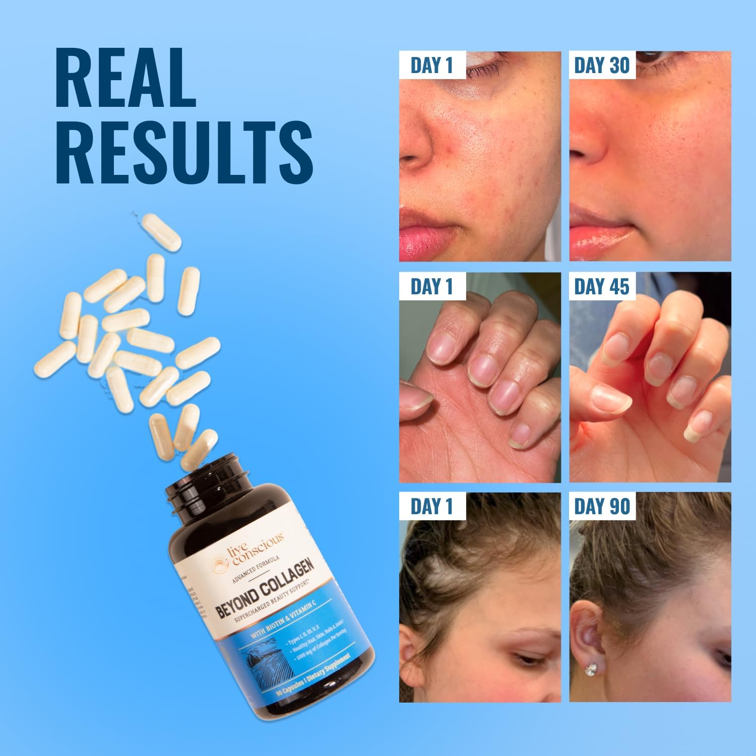 Live Conscious Beyond Collagen Multi Collagen Capsules - Types I, II, III, V & X - Hydrolyzed Blend with Biotin & Vitamin C for Hair, Skin, Nails 90 Capsules