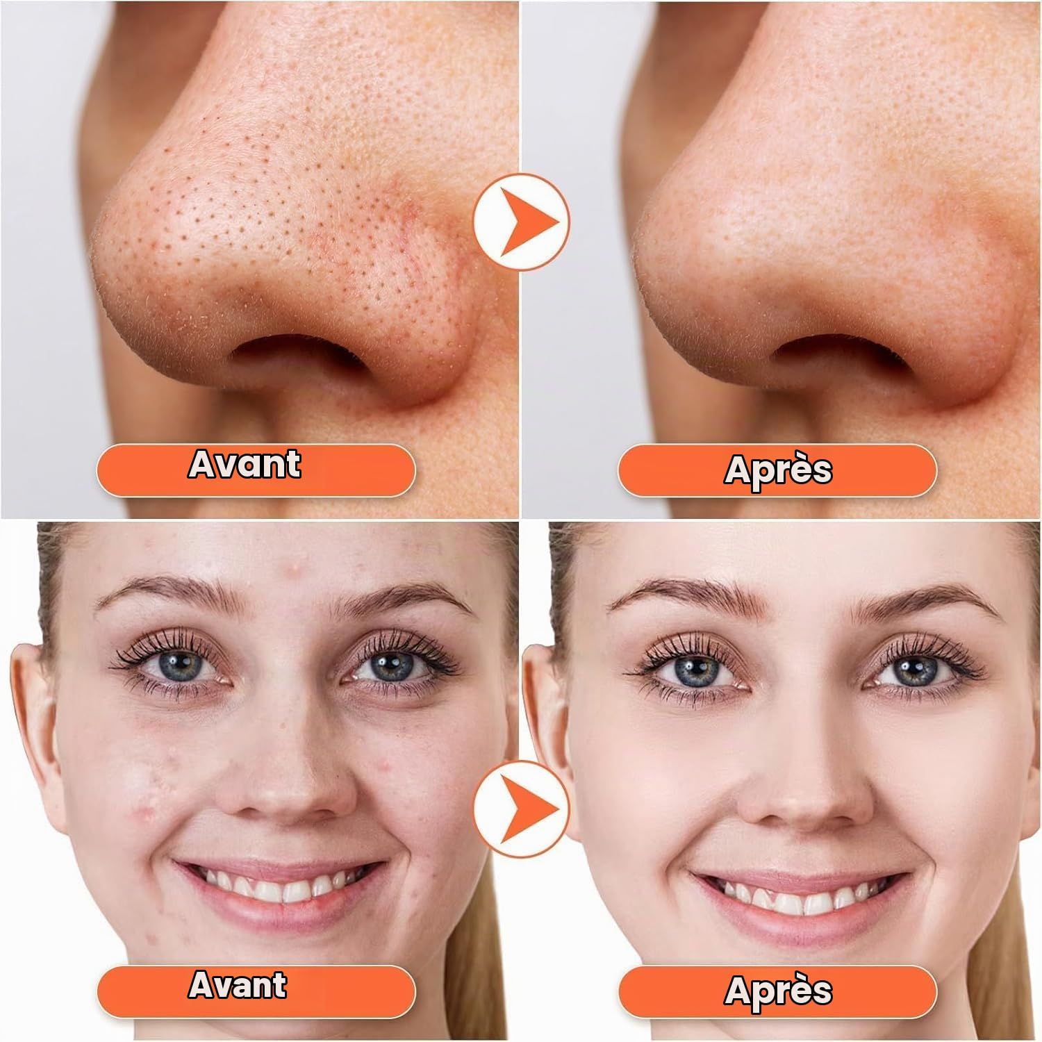 Aspirateur Point Noir Extracteur de Comédons Nettoyage des Pores avec 5 Sondes 3 Modes Points Noirs Anti Point Noir Nez Nettoyage des Pore Peau Soin Visage