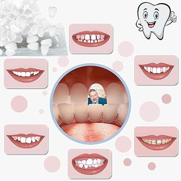 Provisional Tooth Repair Kit-Thermal Fitting Beads Granules and Fake Teeth for Provisional Fixing Missing and Broken Tooth (Teeth - Piece White)