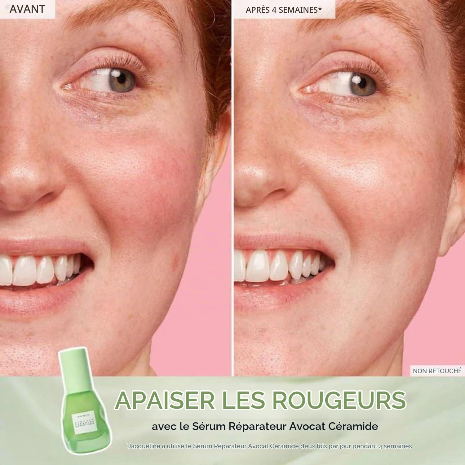 Coffret cadeau de soins de la peau pour fête avec sérum visage Niacinamide Dewdrop Sérum visage avec céramides d'avocat et sérum pour taches de goyave foncée