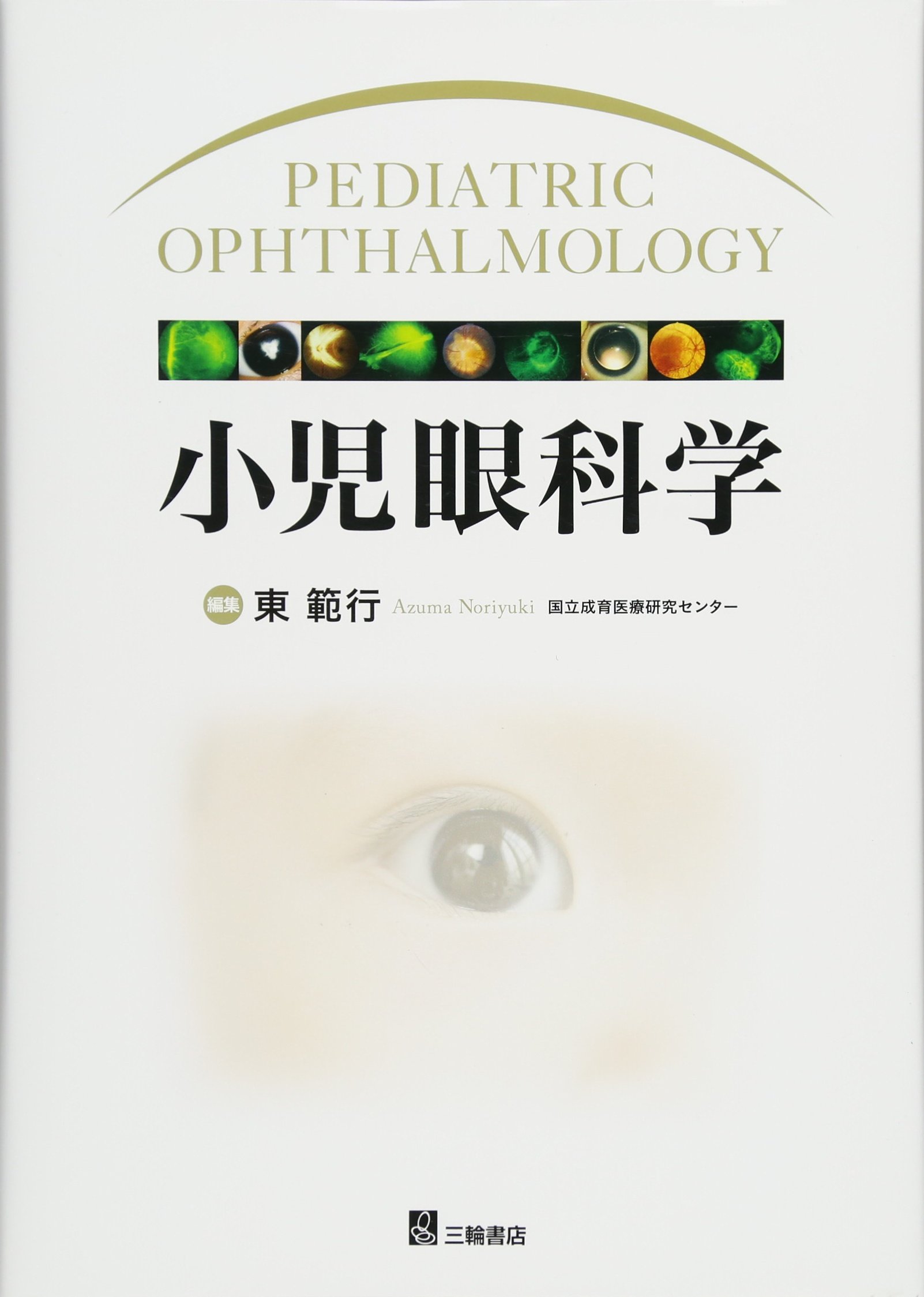 小児眼科学 小児眼科学 小児緑内障の診断と治療 (臨床眼科 69巻
