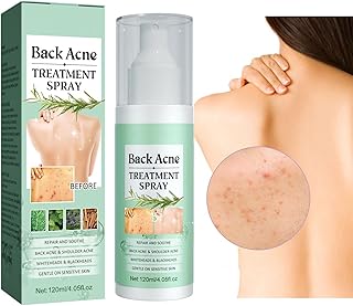 Back Acne Treatment Spray, Acne Spray Back and Chest, Spray for Back Acne, Repair Back Shoulder Acne & Body Acne & Chest Acne & Butt Acne , Gentle on Skin