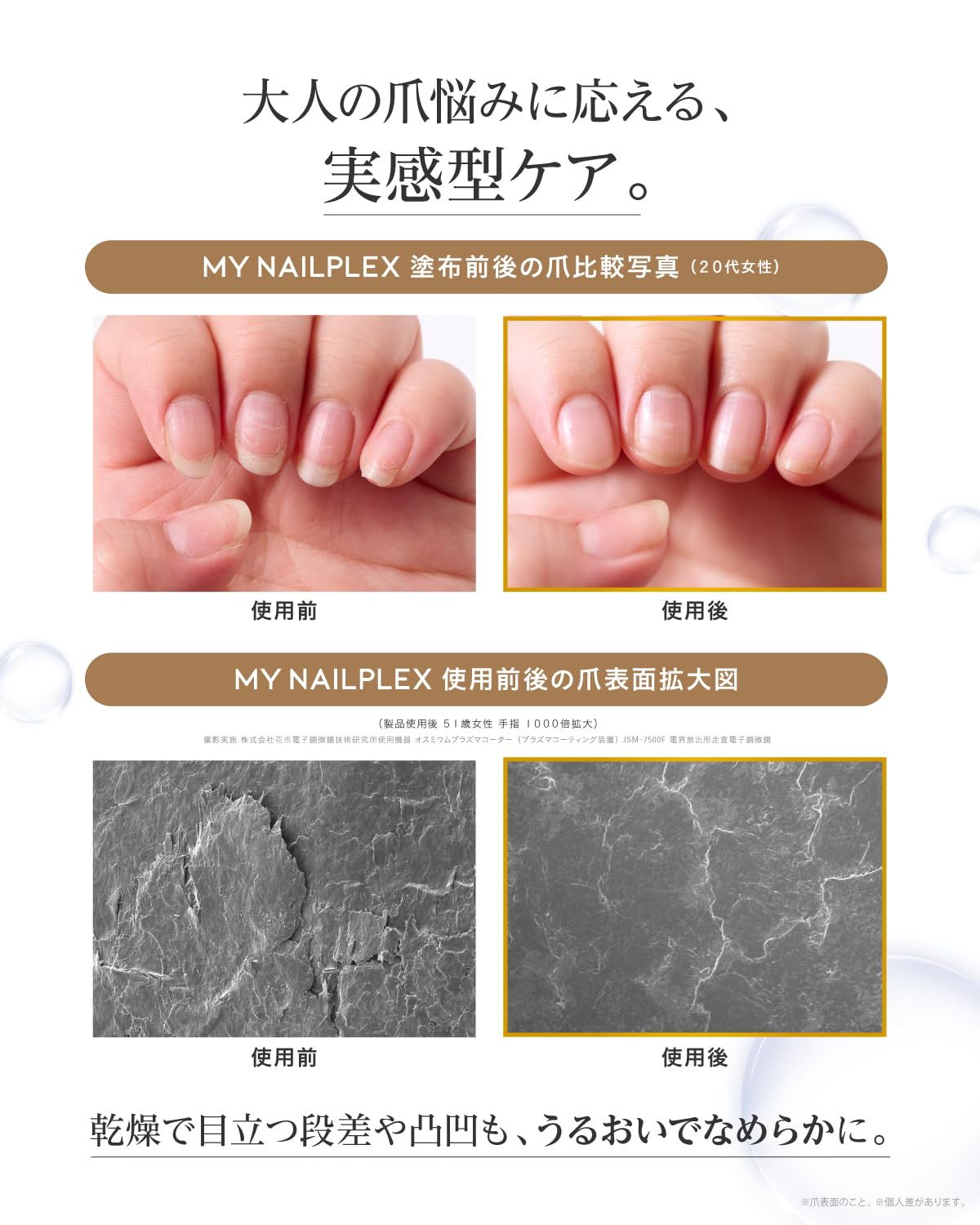 Amazon | 【 ネイルサロン 専売品 チタネイル シリーズ 】 マイネイル