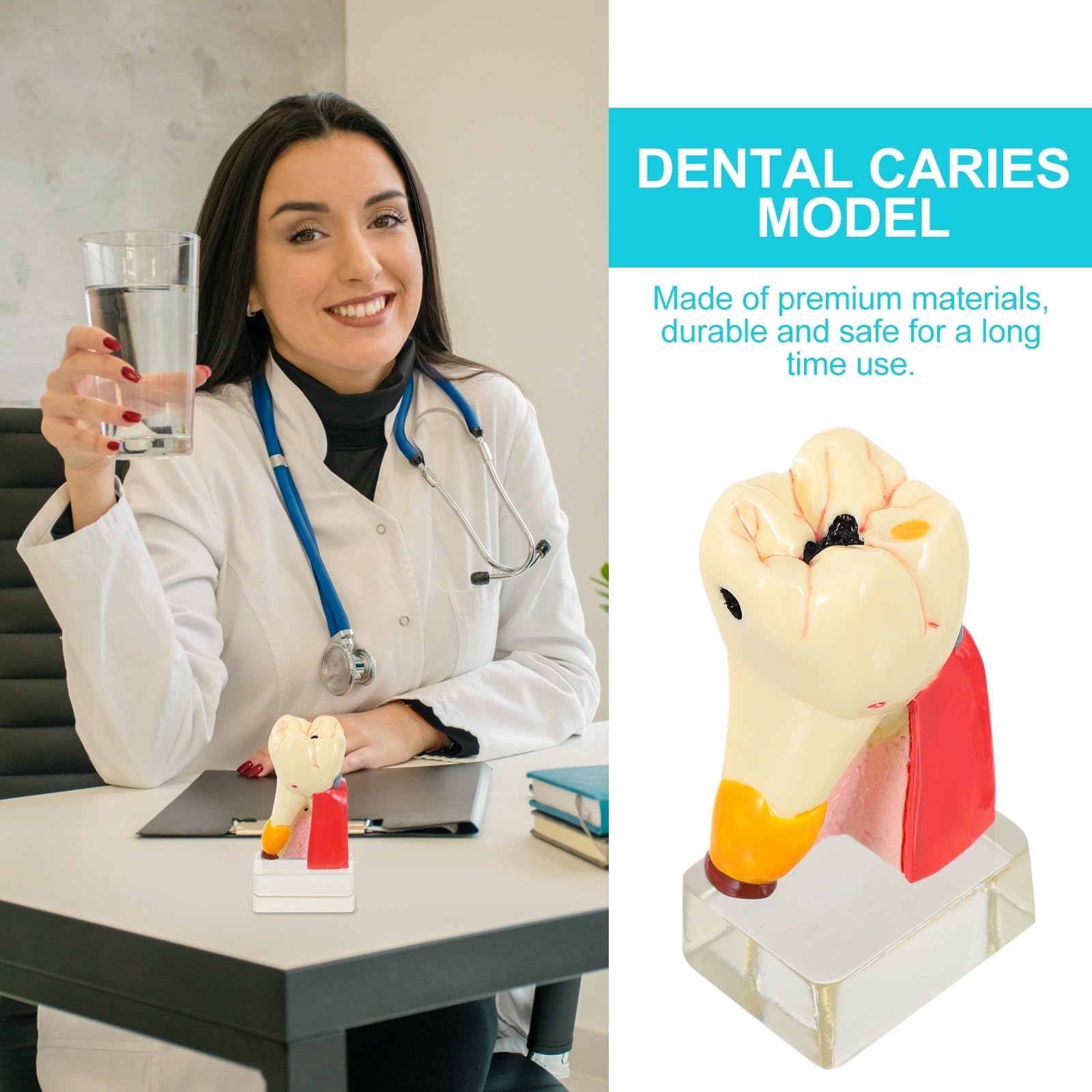 Zerodeko Modèle Anatomique de Carie Dentaire Beige en Résine Portable pour Démonstration Professionnelle des Soins Dentaires par Dentistes