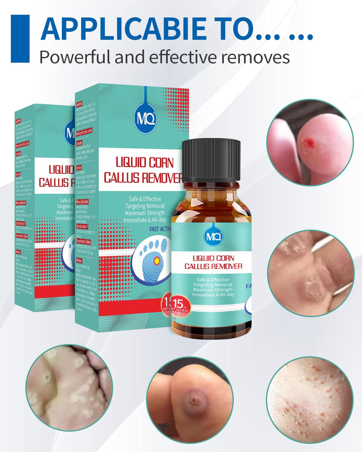 MQ 2Pcs RIMOZIONE LIQUIDA DI VERRUCHE E CALAMBRE, 15ml Rimuovi Verruca, Soluzione Contro Calli e Duroni, Rimuovi Calli, Rimuovi Verruche, Alleviamento del Dolore da Mais e Cura dei Piedi