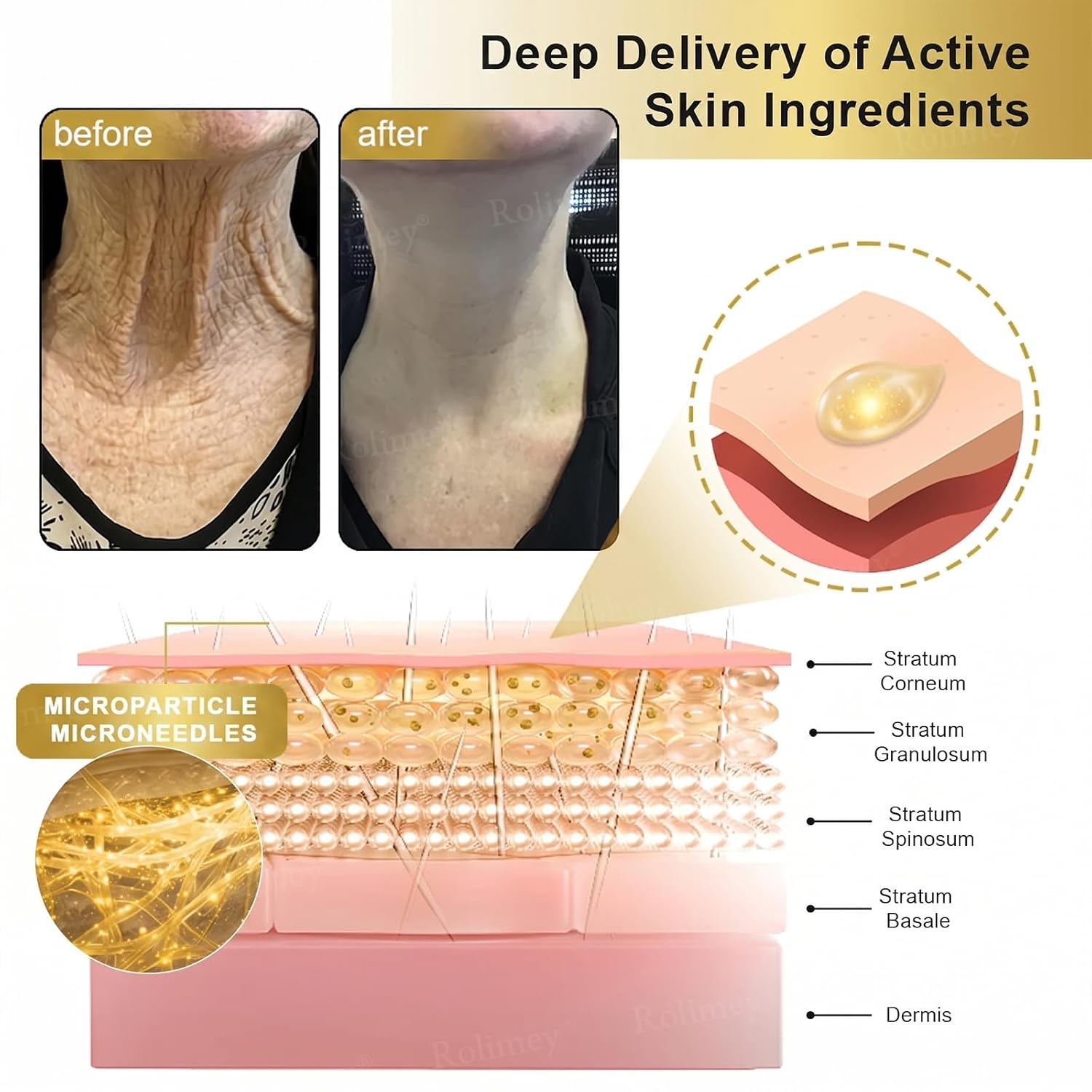 TLOPA Rolimey Collagen Fullerene Cream, Magic Collagen Fullerene Neck Cream with Collagen Peptides, Tightening and Lifting Cream for Crepey Skin, Wrinkles and Tightening for Skin Types (2pcs)