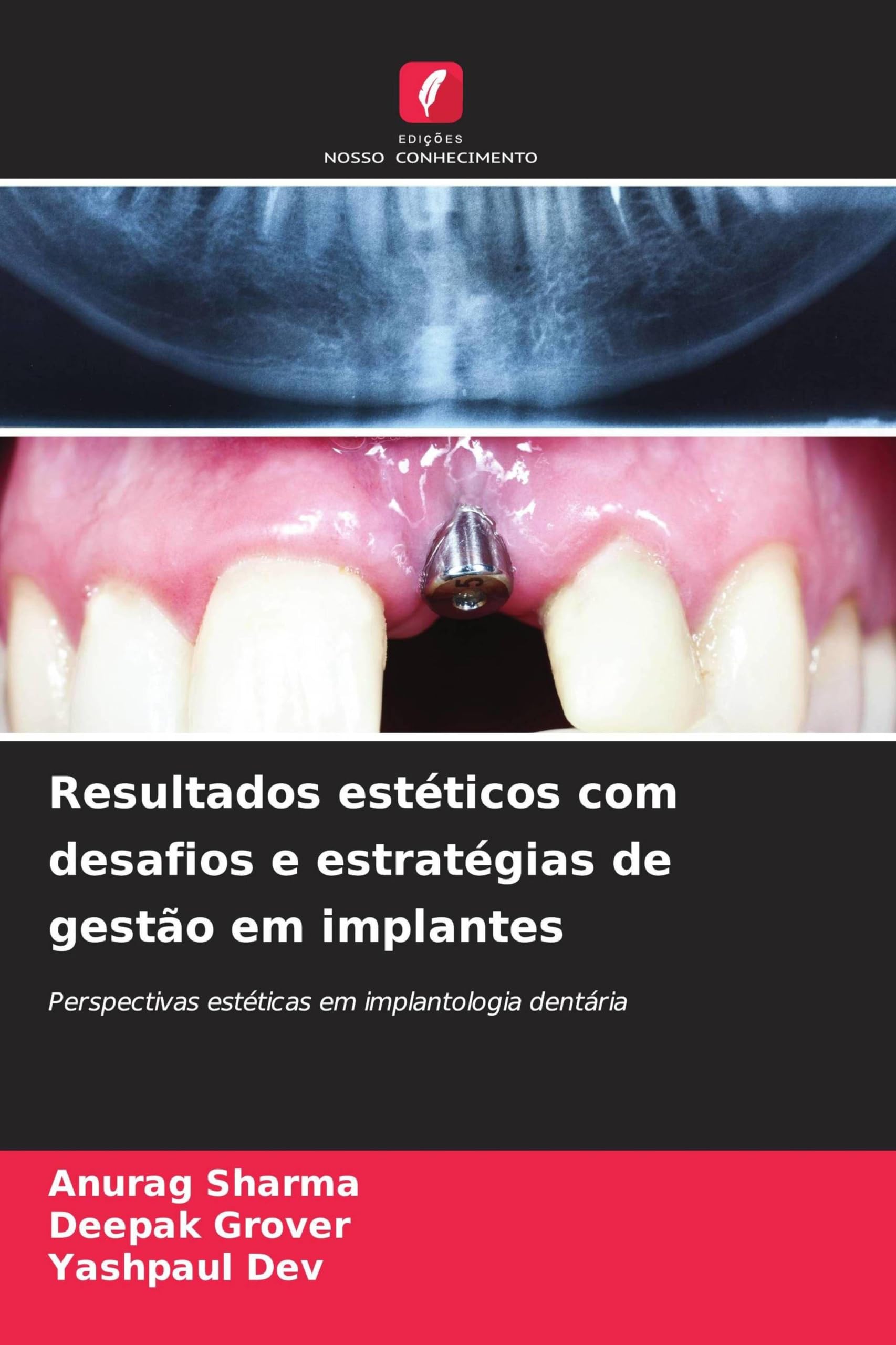 Resultados estéticos com desafios e estratégias de gestão em implantes: Perspectivas estéticas em implantologia dentária