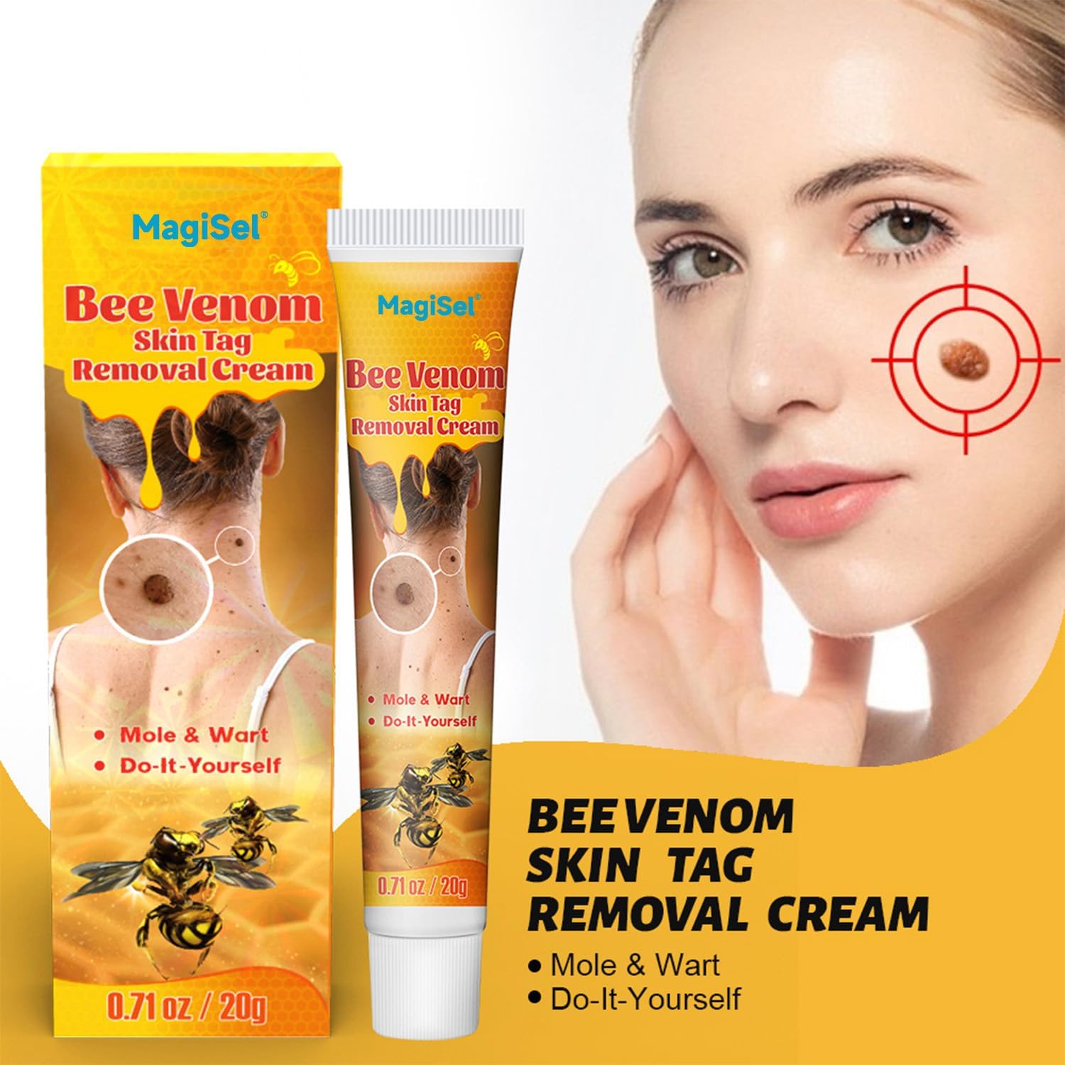 Crème éliminatrice De Verrues à Base D'extrait Naturel - Pour Verrues Génitales Et Plates - 20g - Neuf