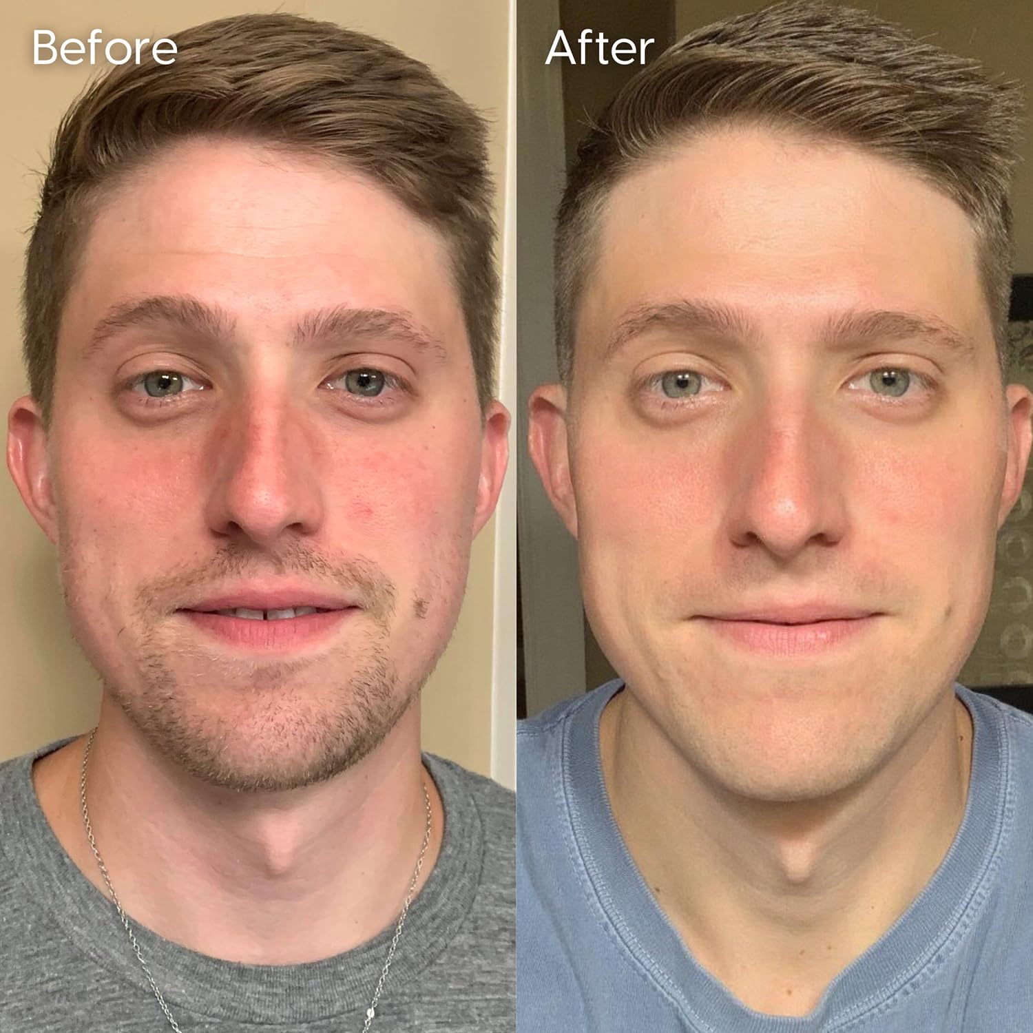 Strive Mens Face Moisturizer, Dark Circle Brightening, Anti Aging Mens Face Lotion with 4% Niacinamide+, Hyaluronic Acid & Ceramides, Hydrating Fragrance Free Skin Care Face Cream - 1.7 fl oz. - Image 6