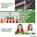 RENESMEE Scalp Massager Shampoo Brush, Eco-friendly Wheat Straw body with Soft Silicon Bristles, Scrubber, Exfoliator | Dandruff Removal, Prevents Hair loss for Men, Women (Green) gallery image