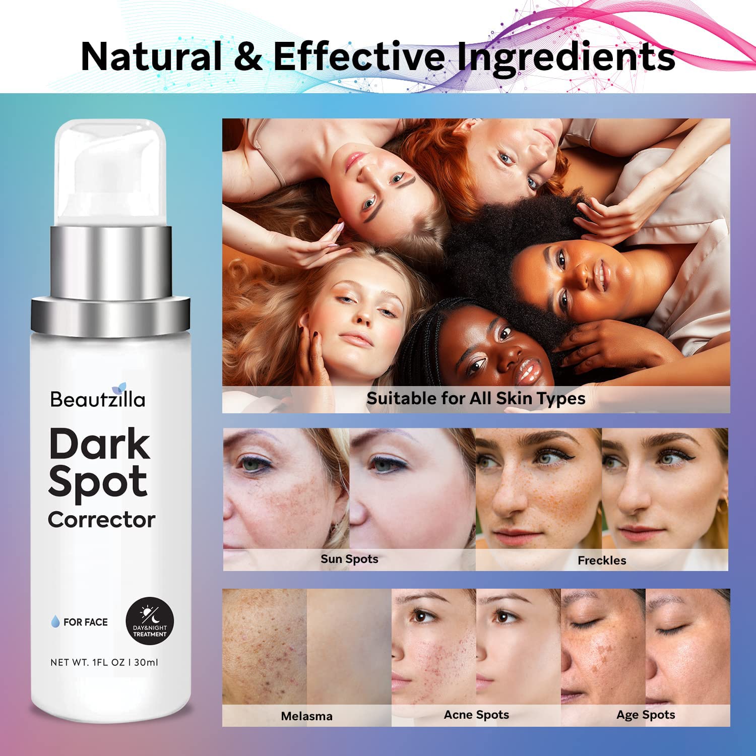 Dark Spot Remover for Face,Dark Spot Corrector Serum,Hyperpigmentation Treatment,Advanced and Natural Formula - - Removes Freckles, Sun Spots, Melasma and More
