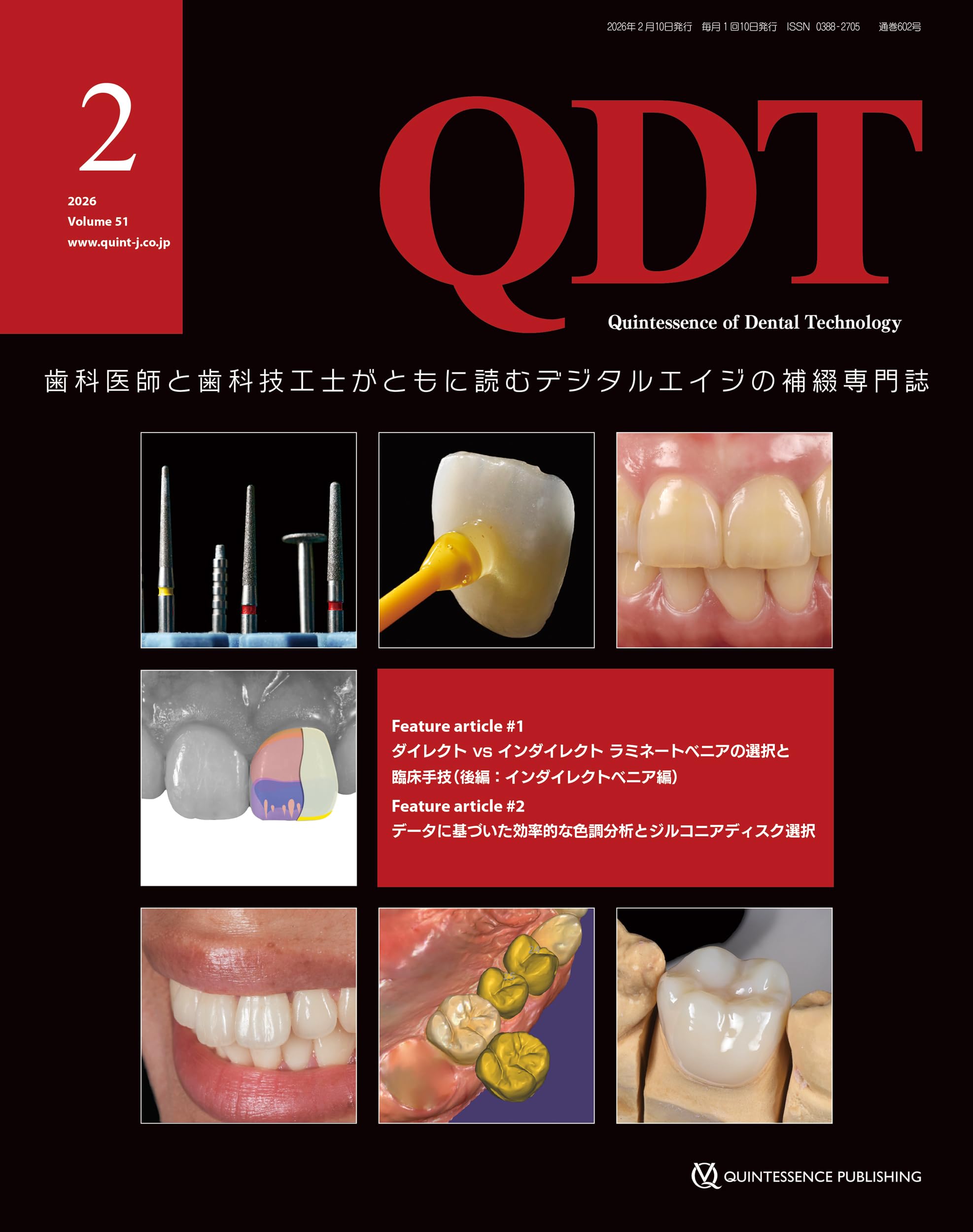 QDT 2026年2月号: 歯科医師と歯科技工士がともに読むデジタルエイジの