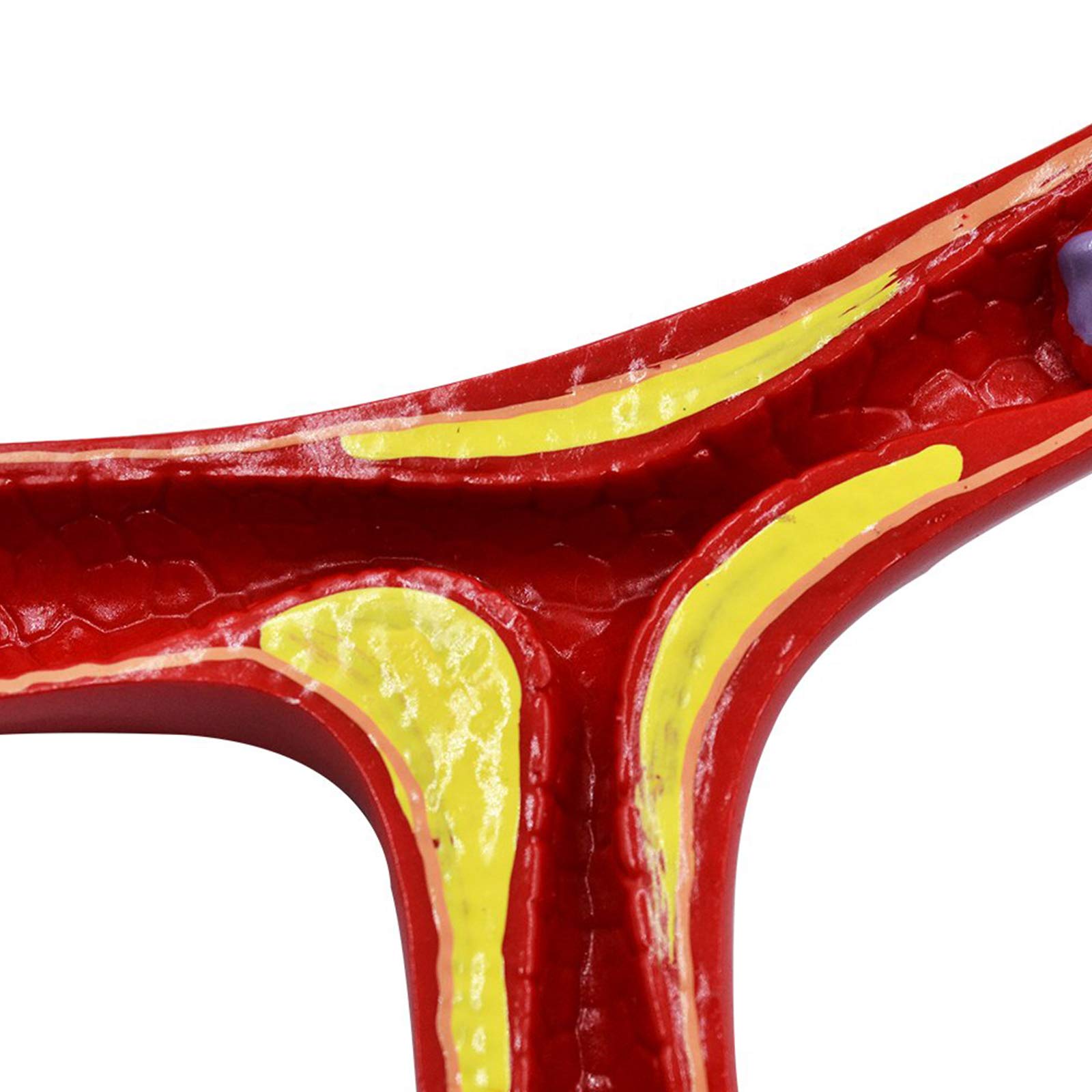 Model układu sercowo-naczyniowego ludzkiej miażdżycy, model anatomiczny naczyń krwionośnych, model skrzepliny do medycznych materiałów dydaktycznych
