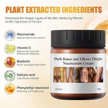 Dark Knuckle Remover Underarm Cream Body Moisturizer Lotion Dark Toe Knuckle Treatment Removal Corrector for Armpit Knees Elbow Inner Thigh Neck Private Part Intimate Skin Cream 4.21floz/120g